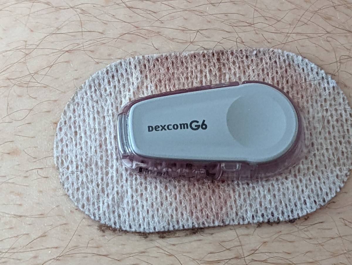 Dexcom G7 CGM szenzor
